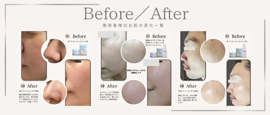 Moaliceトリートメント比較写真