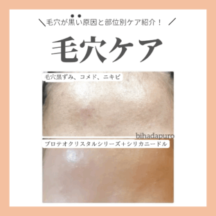 毛穴が黒い原因と部位別ケア紹介！おすすめセルフケアで肌をクリアに