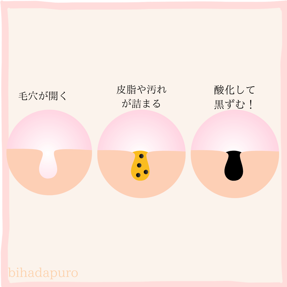 毛穴が黒ずむ仕組み画像
