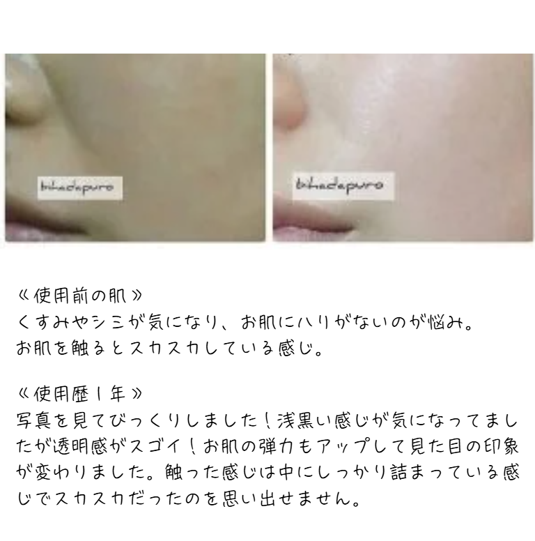 プロテオクリスタル美容液使用レビュー:くすみやたるみ