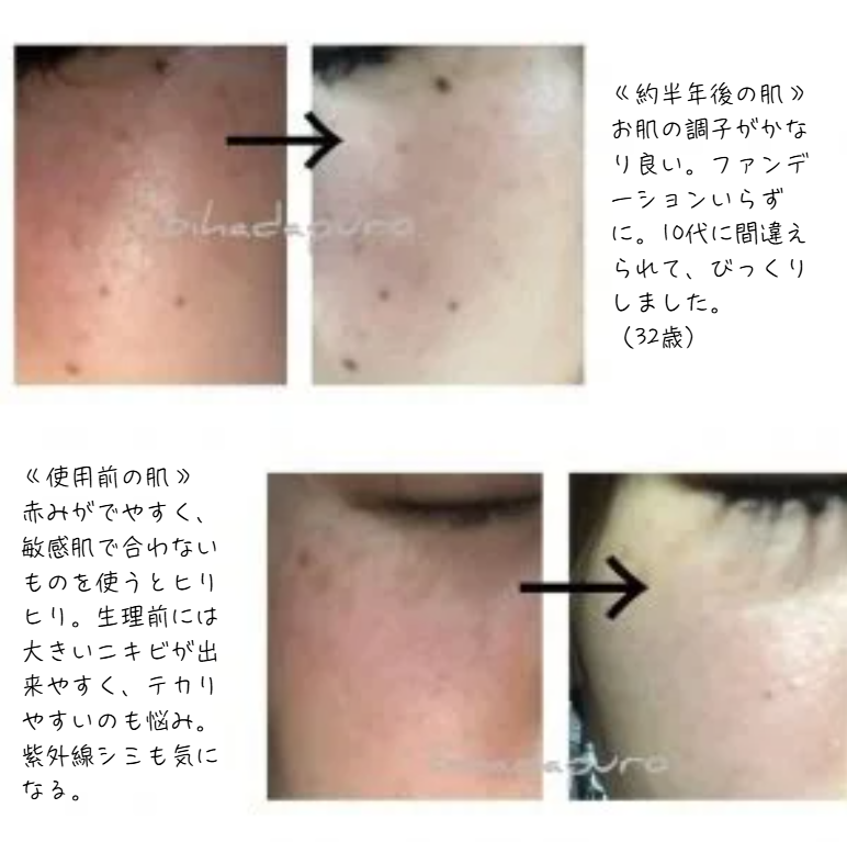 プロテオクリスタル美容液使用レビュー：赤み肌、敏感