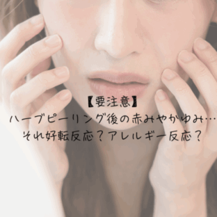 【要注意】ハーブピーリング後の赤みやかゆみ…それ好転反応？アレルギー反応？