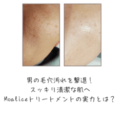 男の毛穴汚れを撃退！スッキリ清潔な肌へ｜Moaliceトリートメントの実力とは？
