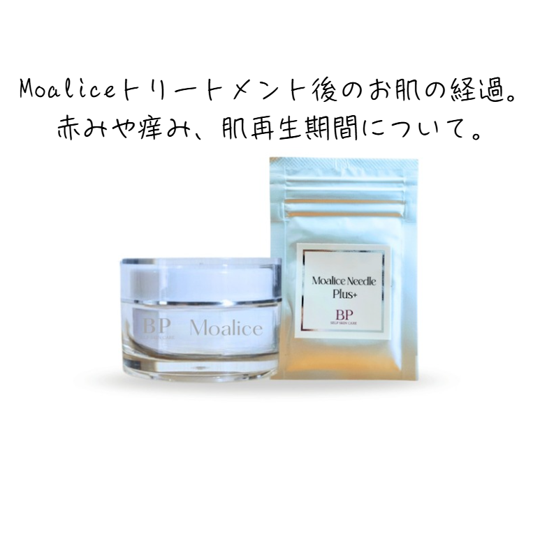 スピキュールケア（Moalice）後のお肌の経過。赤みや痒み、肌再生期間