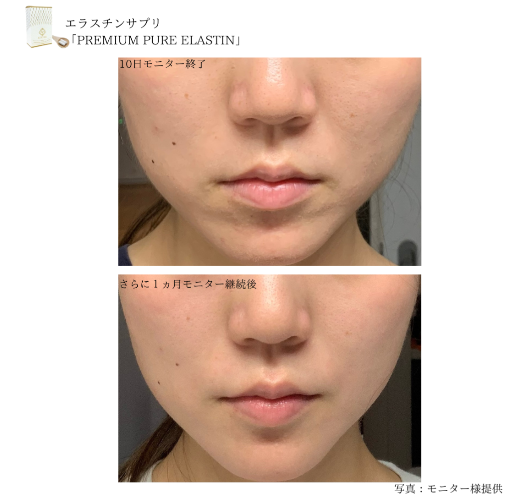 プレミアムピュアエラスチンサプリモニター追加1ヵ月