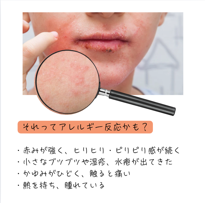 ハーブピーリング後のアレルギーの見分け方