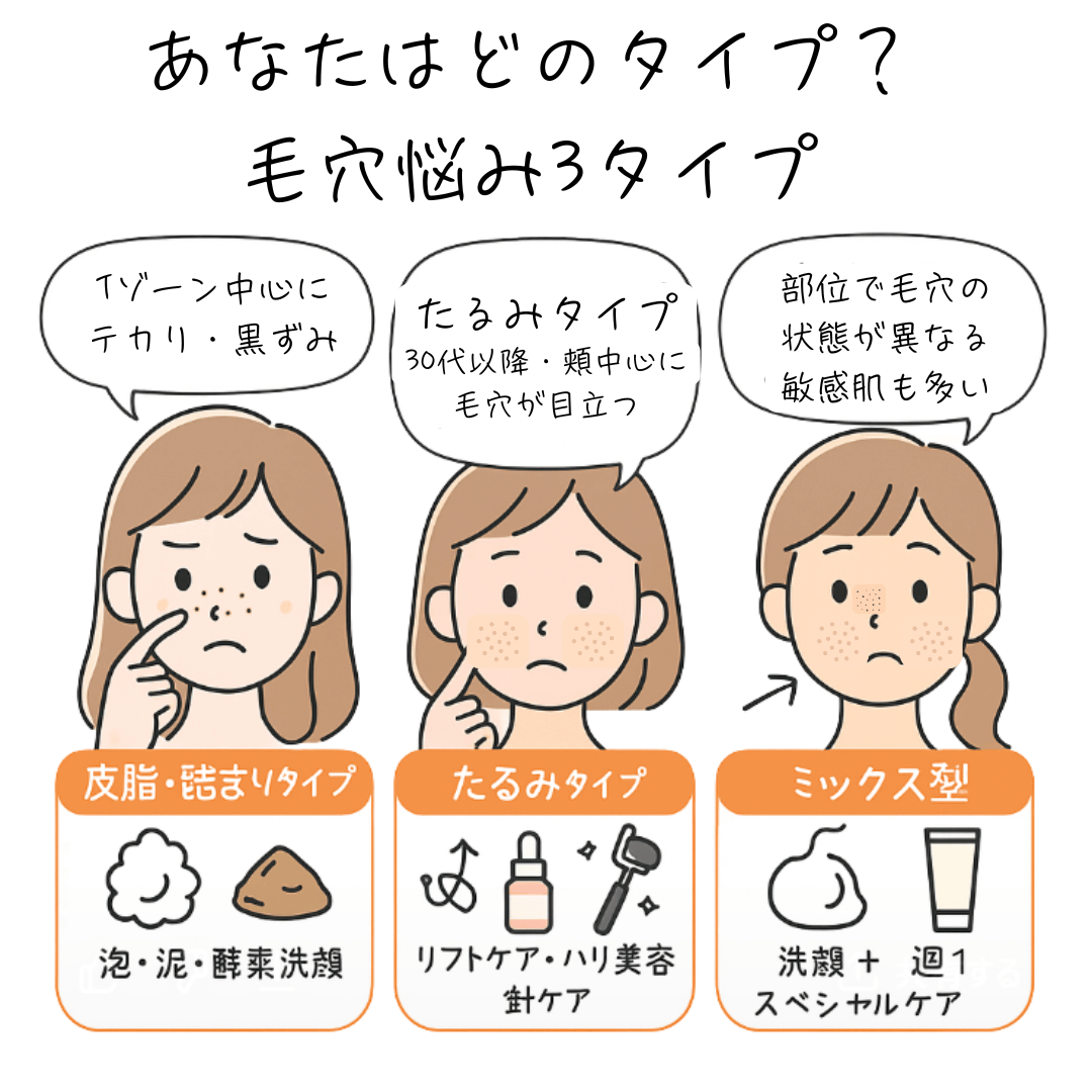 毛穴の開き3タイプのイメージ