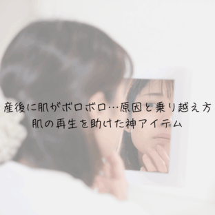 産後に肌がボロボロ…原因と乗り越え方｜肌の再生を助けた神アイテム