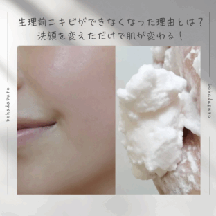 生理前ニキビができなくなった理由とは?洗顔を変えただけで肌が変わる!