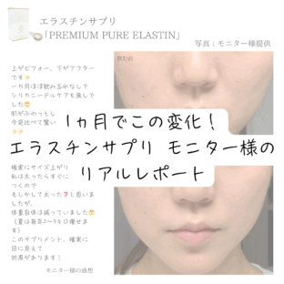 【写真あり】エラスチンサプリの効果は？1ヶ月のリアル口コミレビュー