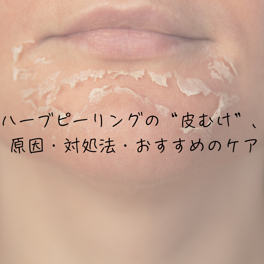 ハーブピーリングの“皮むけ”、不安に思ったら読んで。原因・対処法
