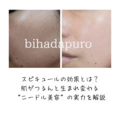 【元エステ直伝】スピキュールとは？効果・痛み・使い方まで徹底解説