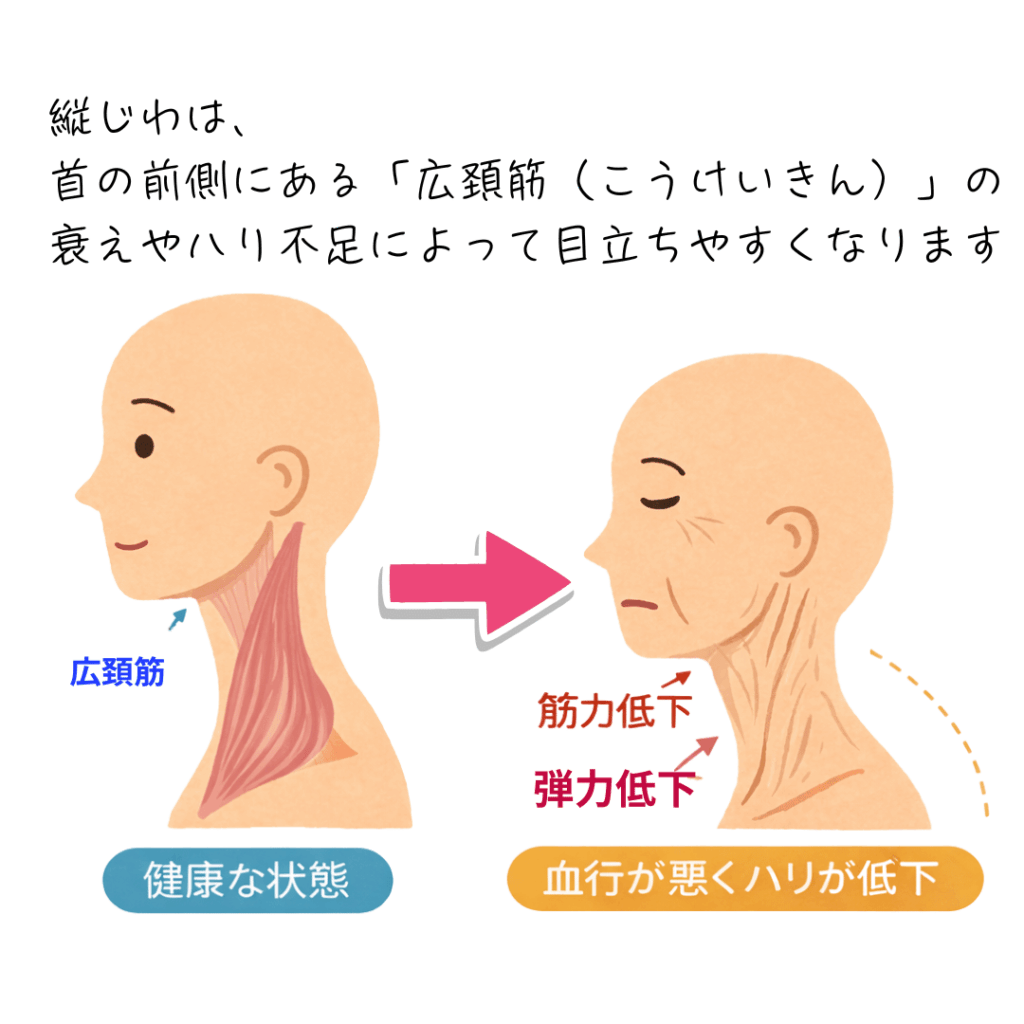 縦じわは、首の前側にある広頚筋の衰えやハリ不足で目立つ説明画像