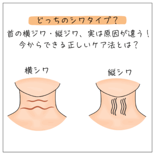 首の横ジワ・縦ジワ、実は原因が違う！今からできる正しいケア法とは？