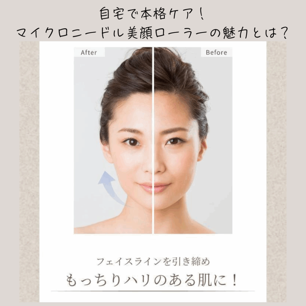 自宅で本格ケア！マイクロニードル美顔ローラーの魅力イメージ