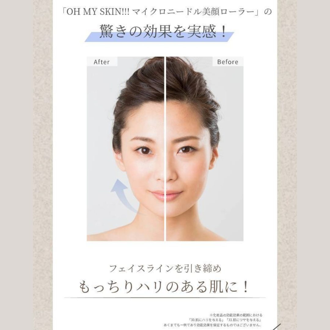 マイクロニードル美顔ローラー比較写真
