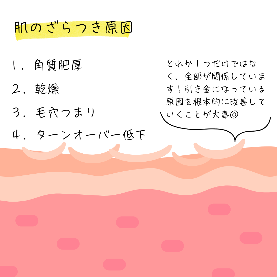 肌がざらつく原因４つを説明した画像