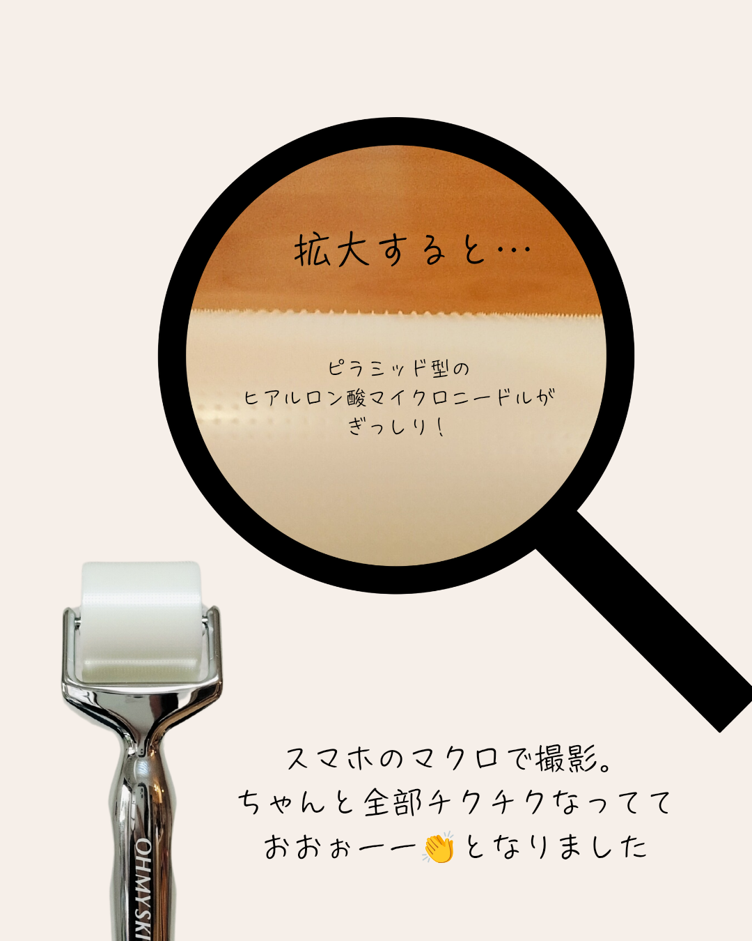 マイクロニードル美顔ローラーのニードル部分拡大