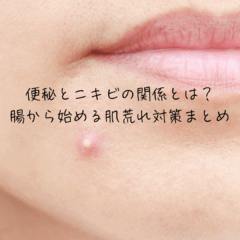 便秘とニキビの関係とは？腸から始める肌荒れ対策まとめ