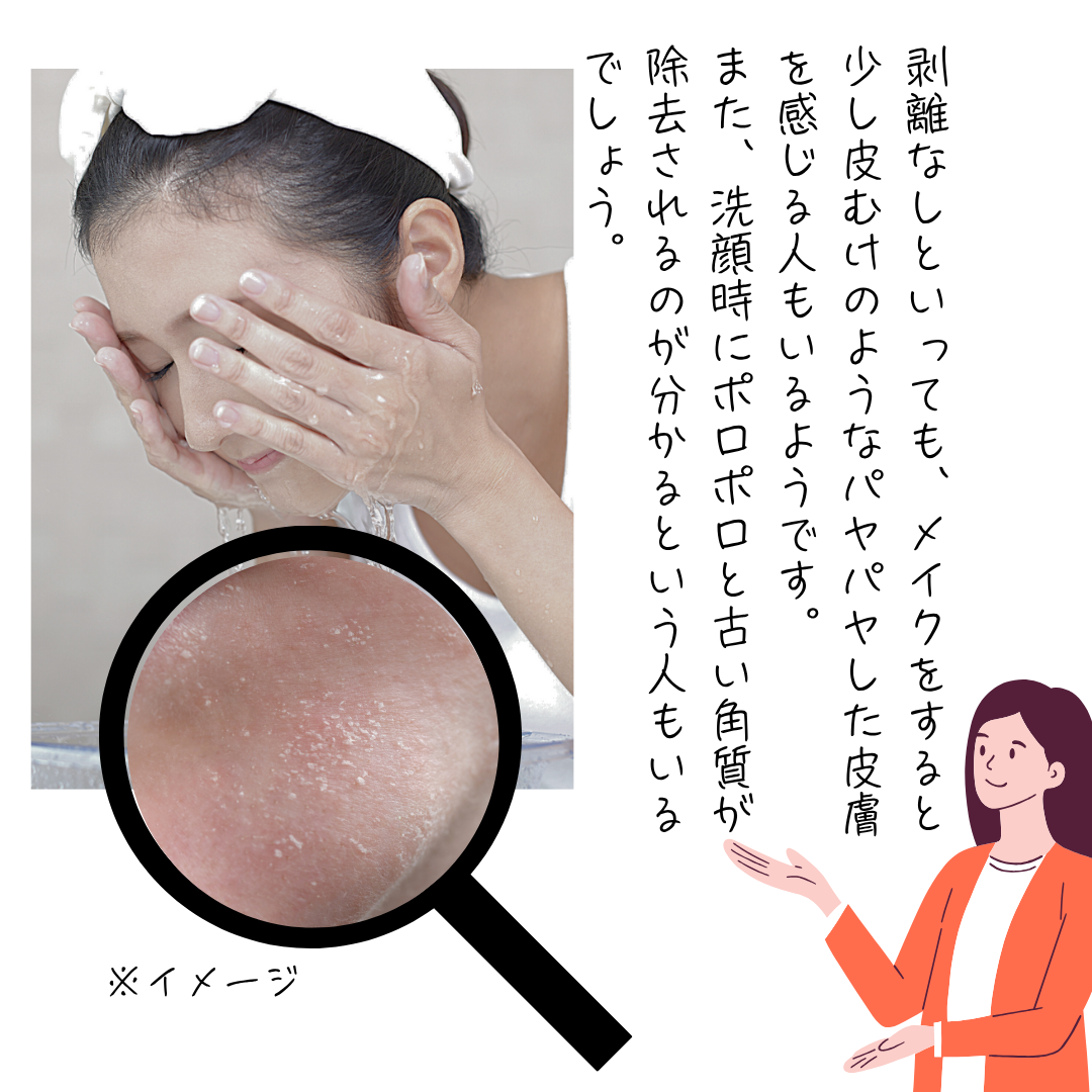 ハーブピーリング後の剥離なしでも洗顔時にポロポロすることがある