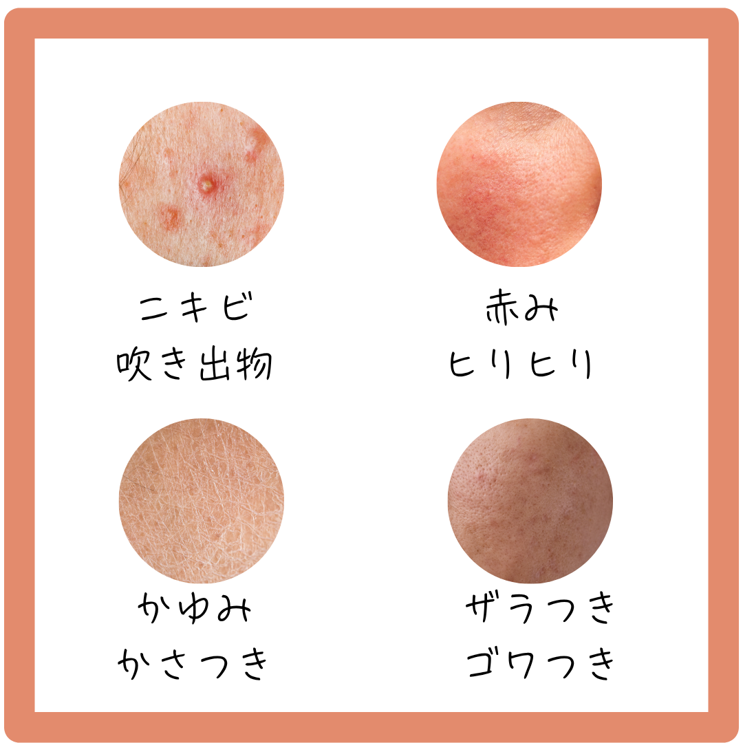 夏の肌荒れ種類