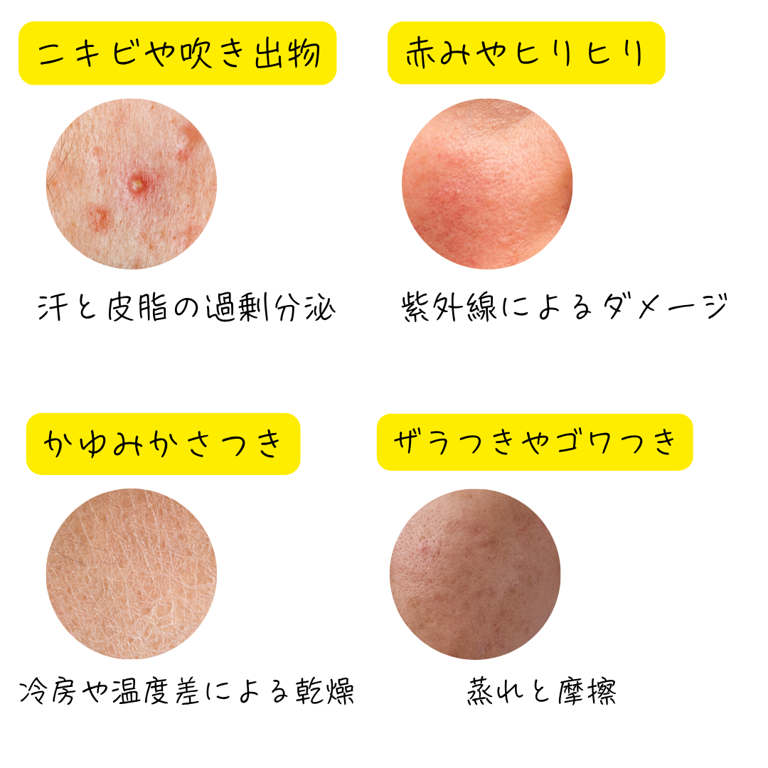 夏の肌荒れ原因