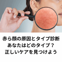 赤ら顔の原因とタイプ診断｜あなたはどのタイプ？正しいケアを見つけよう