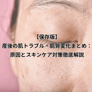 【保存版】産後の肌トラブル・肌質変化まとめ：原因とスキンケア対策徹底解説