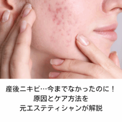 産後ニキビ…今までなかったのに！原因とケア方法を元エステティシャンが解説