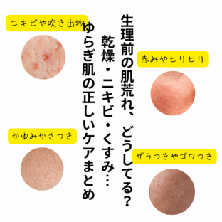 生理前の肌荒れ、どうしてる?乾燥・ニキビ・くすみ…ゆらぎ肌の正しいケアまとめ