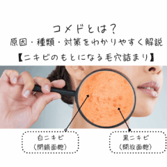 コメドとは？原因・種類・対策をわかりやすく解説【ニキビのもとになる毛穴詰まり】
