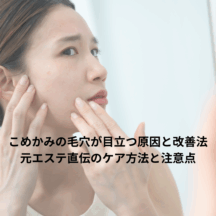 こめかみの毛穴が目立つ原因と改善法|元エステ直伝のケア方法と注意点