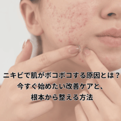 ニキビで肌がボコボコする原因とは？今すぐ始めたい改善ケアと、根本から整える方法