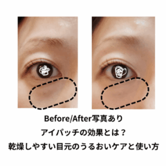 Before/After写真あり｜アイパッチの効果とは？乾燥しやすい目元のうるおいケアと使い方