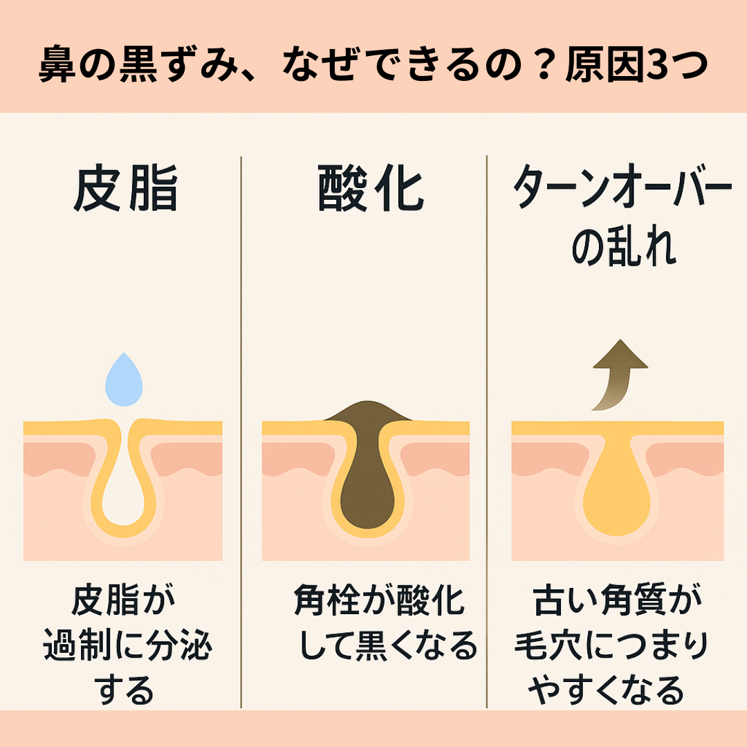 鼻の黒ずみ、なぜできるの?原因3つ