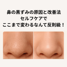 鼻の黒ずみの原因と改善法｜セルフケアでここまで変わるなんて反則級！