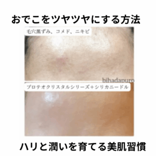 おでこをツヤツヤにする方法｜ハリと潤いを育てる美肌習慣