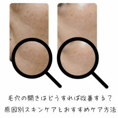 毛穴の開きはどうすれば改善する？原因別スキンケアとおすすめケア方法