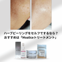 ハーブピーリングをセルフでするなら？おすすめは「Moaliceトリートメント」