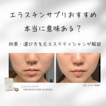 エラスチンサプリおすすめ｜本当に意味ある？効果・選び方を元エステティシャンが解説