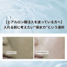 【ヒアルロン酸注入を迷っている方へ】入れる前に考えたい“保水力”という選択