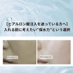 【ヒアルロン酸注入を迷っている方へ】入れる前に考えたい“保水力”という選択