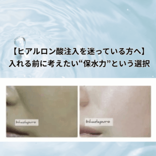 【ヒアルロン酸注入を迷っている方へ】入れる前に考えたい“保水力”という選択