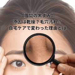 【眉間の黒ずみ】原因は乾燥？毛穴汚れ？自宅ケアで変わった理由とは