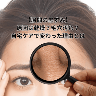 【眉間の黒ずみ】原因は乾燥？毛穴汚れ？自宅ケアで変わった理由とは