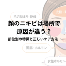顔のニキビは場所で原因が違う？部位別の特徴と正しいケア方法