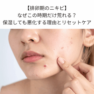 【排卵期のニキビ】なぜこの時期だけ荒れる？保湿しても悪化する理由とリセットケア
