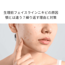 生理前フェイスラインニキビの原因｜顎とは違う？繰り返す理由と対策