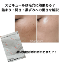 スピキュールは毛穴に効果ある？詰まり・開き・黒ずみへの働きを解説