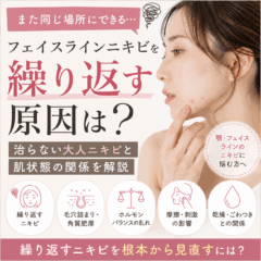 フェイスラインニキビを繰り返す原因は？治らない大人ニキビと肌状態の関係